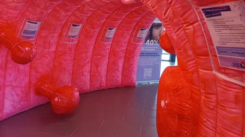 Segré. Un côlon géant gonflable pour inciter au dépistage du cancer
