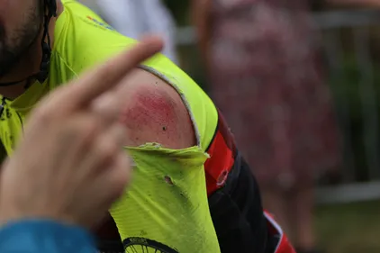 Pommerieux : en pleine course cycliste, une partie du peloton chute...
