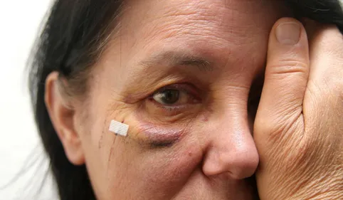 Des photos pour dénoncer les violences conjugales