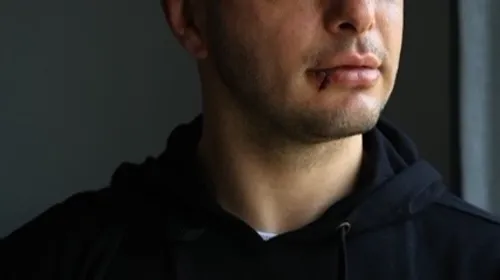 Le champion castrais de MMA Cédric Séverac se "régale" dans son...