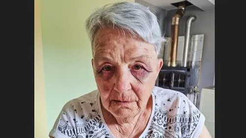 INFO 100%. Une élue ariégeoise violemment agressée 