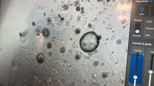 Strasbourg, place forte de la recherche contre le cancer