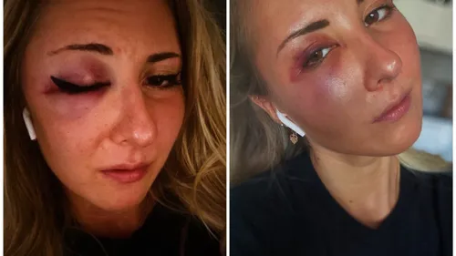 Strasbourg :  l'affaire de l'agression pour une jupe classée 