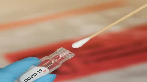 Multiplication des dépistages, pharmacies en surchauffe