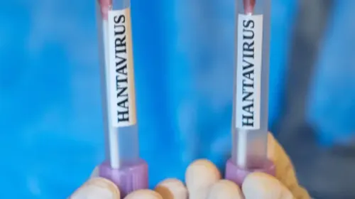 Hantavirus : les 26 cas contacts français sans symptôme, mais...