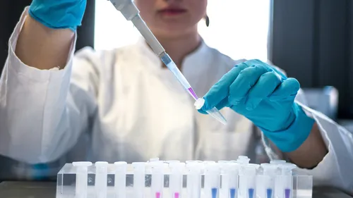 Les salariés des laboratoires de biologie médicale sont en grève ce...
