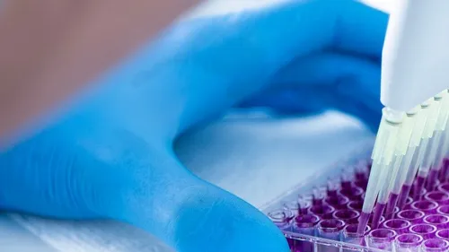 Influenza aviaire : des mouettes contaminées dans l'Eure