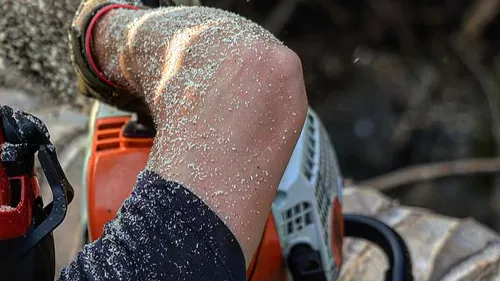 Près de Rouen, il s'entaille la cheville avec sa tronçonneuse