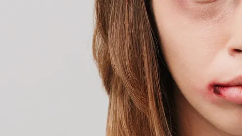 En Mayenne, plus d'un demi-millier de faits de violence conjugale à...