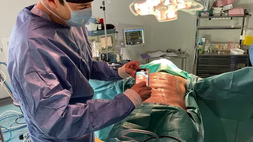 Au Mans, le patient se fait "greffer" des abdos 