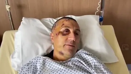 Le policier agressé à Rive de Gier témoigne dans une vidéo