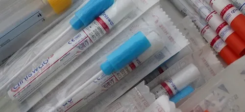 Covid-19 : des tests gratuits dans la métropole de Tours avant les...