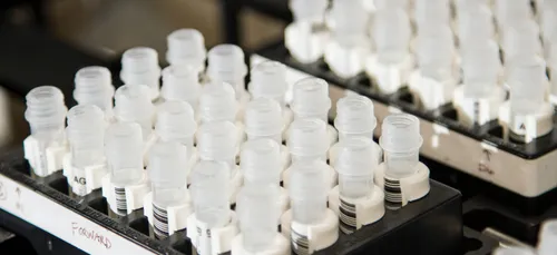 Covid-19 : les CHU de Nantes et Angers pourront détecter les variants