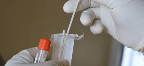 Covid-19 : un premier cas de variant brésilien identifié en Allemagne