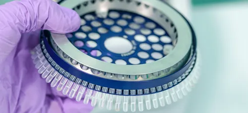 Covid-19 : un variant alsacien détecté