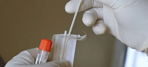 Covid-19 : Les autotests vendus en pharmacie dès le 12 avril