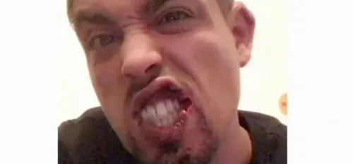 (Vidéo) Agressé il y a une semaine, Lartiste donne des nouvelles...