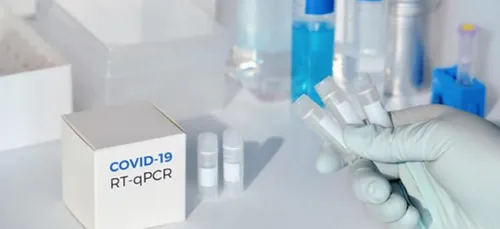 L'Algérie lance sa production de kits de dépistage : une première...