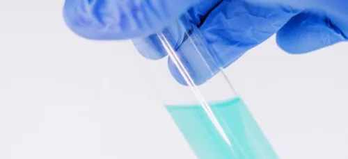 Nouvelle-Aquitaine : les laboratoires de biologie médicale en grève...