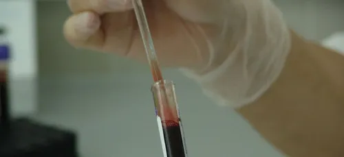 Nouvelle-Aquitaine : les laboratoires d’analyses médicales en grève