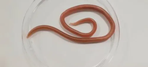 Une femme vomit un ver de 20 cm au CHU de Nantes (Photo)