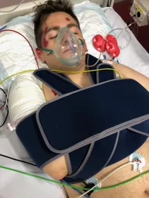 Laissé pour mort par un chauffard, son témoignage sur Champagne FM