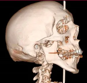 Des médecins rémois réalisent un miracle