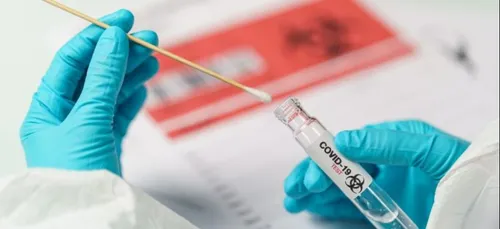 42 foyers de contamination en région