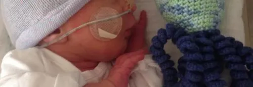 Des "pieuvres" pour rassurer les bébés hospitalisés