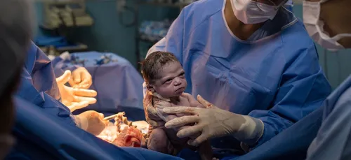 Cette photo d'un bébé à peine sorti du ventre de sa maman fait le...