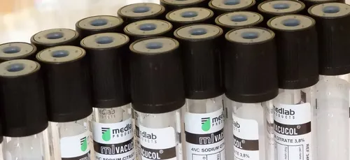 Les tests de COVID-19 sont possibles en laboratoires de ville