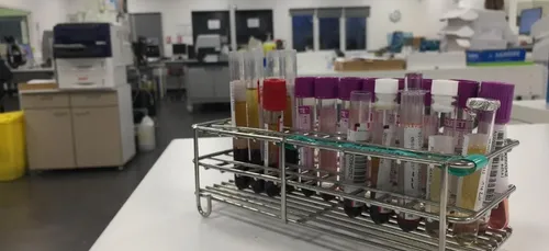 Pas-de-Calais : des tests pour savoir si vous avez contracté le...