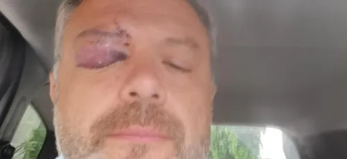 Le maire d'Eppeville frappé lors du bal du 14 juillet