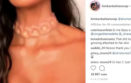 Nouvelle mode : des bijoux implantés sous la peau !