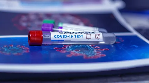 Face à la Covid-19, situation stable dans la Région