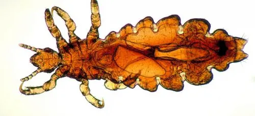 La rentrée des poux !