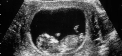 Quels sont les prénoms les plus populaires en Lorraine ?