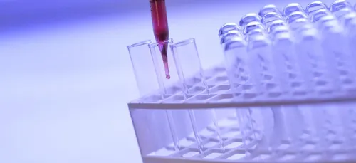 COVID-19 | La ville de Strasbourg permet aux jeunes de se faire...