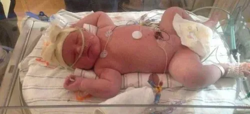 Une femme accouche d’un bébé de 7 kilos (photos)