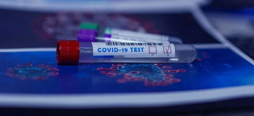 Loiret : un petit foyer de Covid-19 détecté chez Veolia à Chaingy