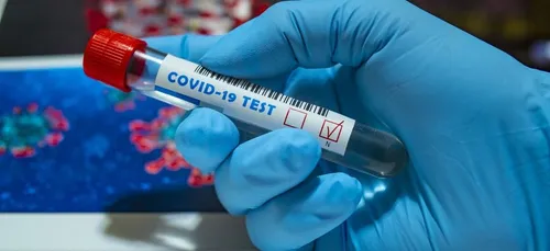 Cholet : un dépistage Covid-19 organisé