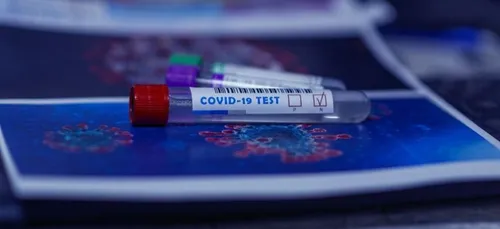 L'épidémie poursuit sa progression dans le Loiret