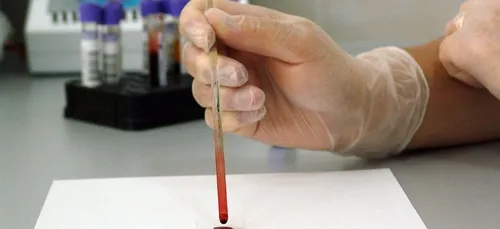 Des chercheurs ligériens au cœur d’un plan de lutte européen contre...