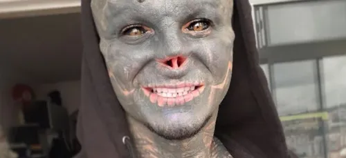 Après les oreilles et le nez, le Français "Black Alien" se fait...