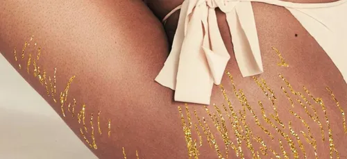 Cette artiste espagnole transforme les vergetures des femmes en...