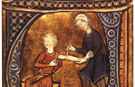 Top 3 des pires remèdes du Moyen Âge