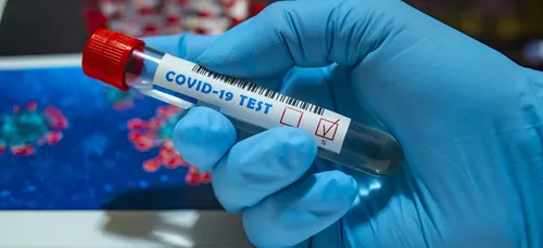 Covid-19 : un foyer de contamination en Haute-Vienne