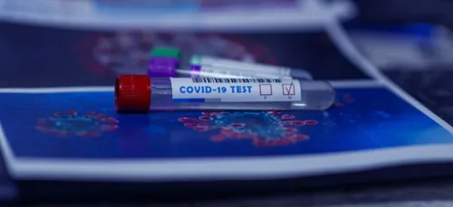 Tours :  plusieurs dizaines de nouveaux cas de COVID découverts à...