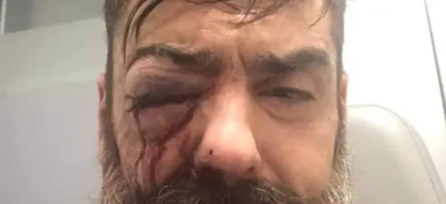 Jérôme Rodrigues annonce qu’il va perdre son œil