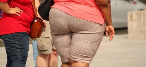 D’ici 2045, près d’un quart de la population pourrait être obèse !